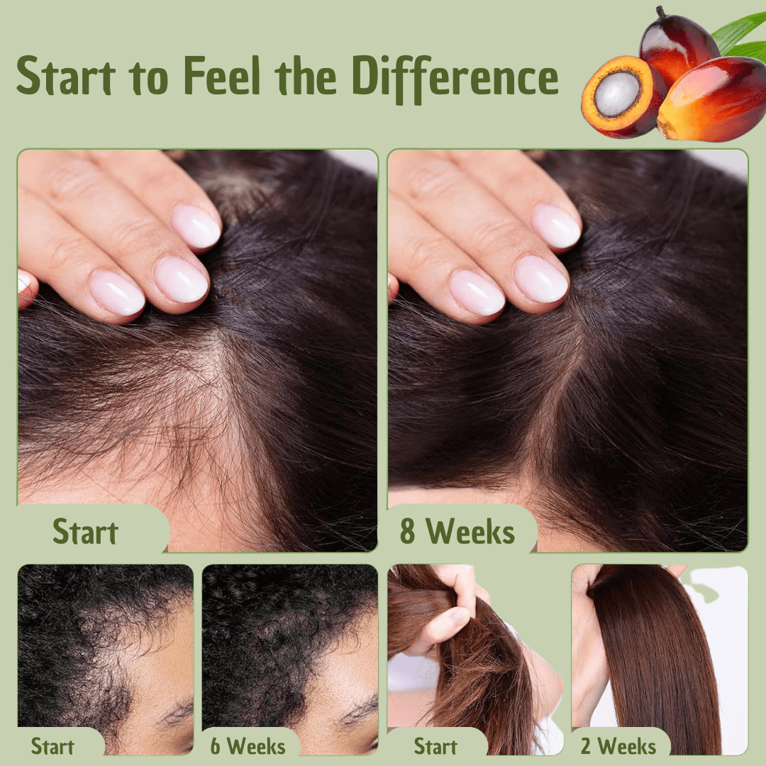 Hair Oil for All Hair Types | Omega Fatty Acids, Vitamin E & Antioxidants | Deep Hydration, Strengthening & Shine