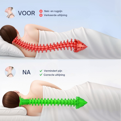 CerviRest™ l The Ergonomic Neck and Sleep Pillow