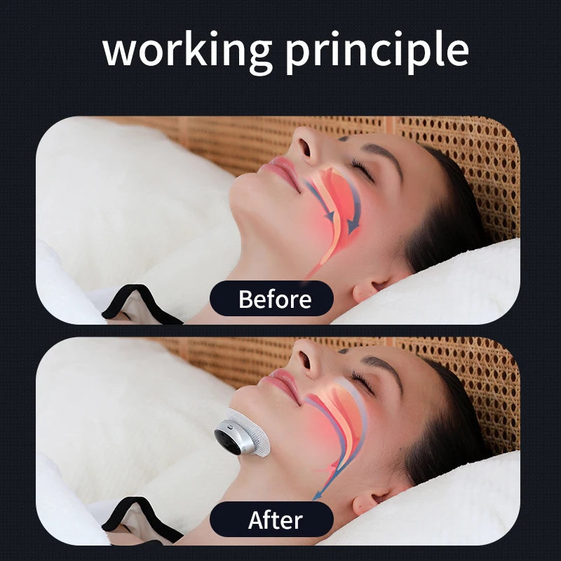 Anti Snoring Device – Dual Pulse Muscle Stimulator | Sleep Aid for Solve Snoring Support 7