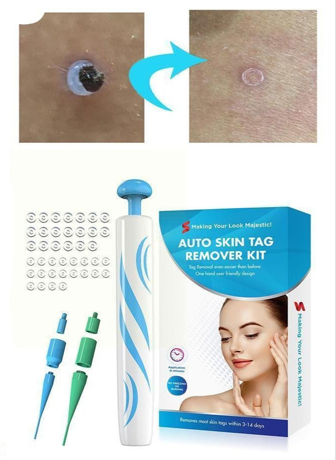 Auto Skin Tag Remover Painless 1