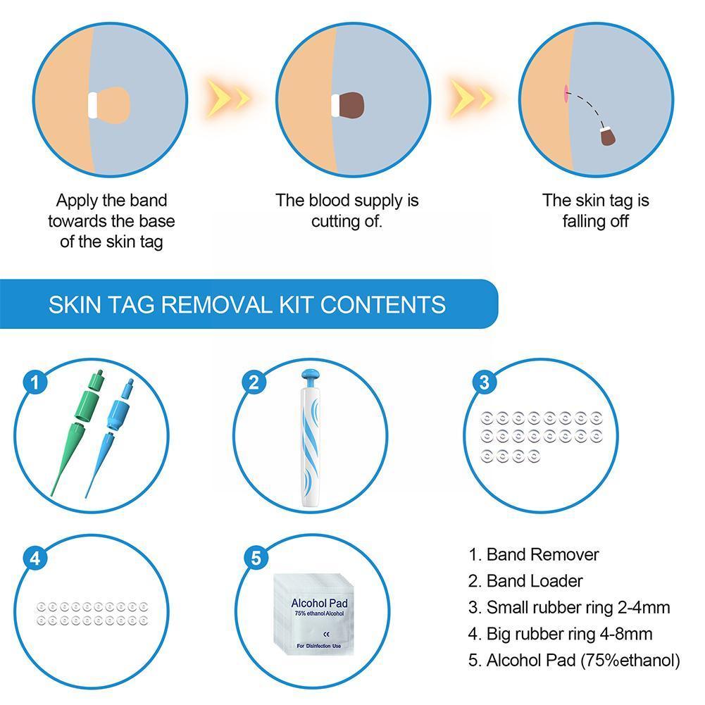 Auto Skin Tag Remover Painless 3