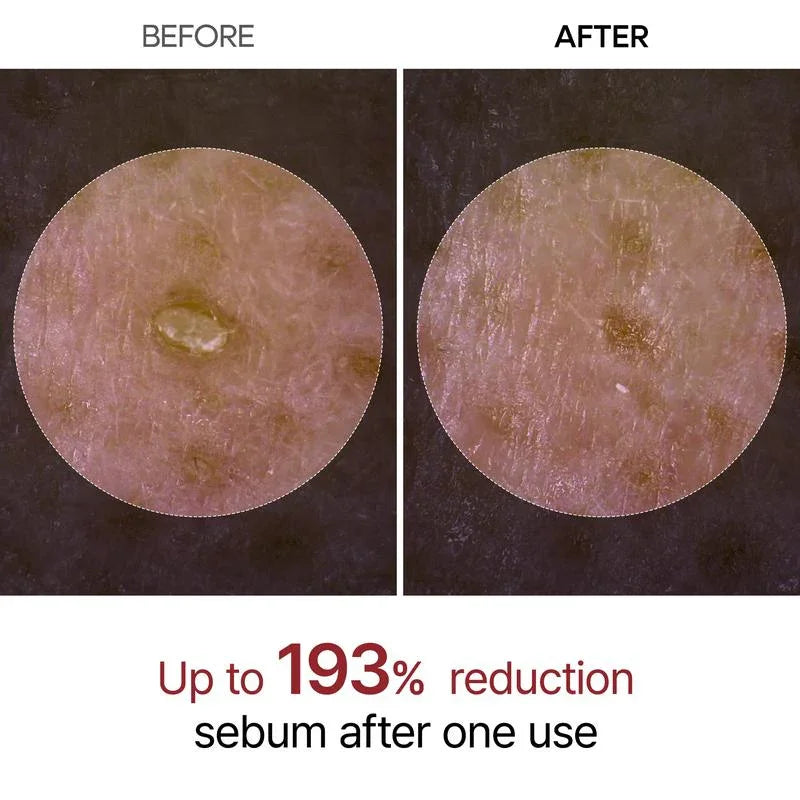Pore Refining Rice Ampoule Serum for Women | Rice Bran Water & Clinical Acid Formula | Reduces Blackheads & Enlarged Pores