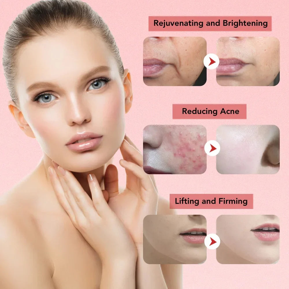 Ultrasonic Skin Lifting Tool | EMS Microcurrent, Ion Therapy & Deep Cleanse | Facial Sculpting Device for Firmer Skin 6