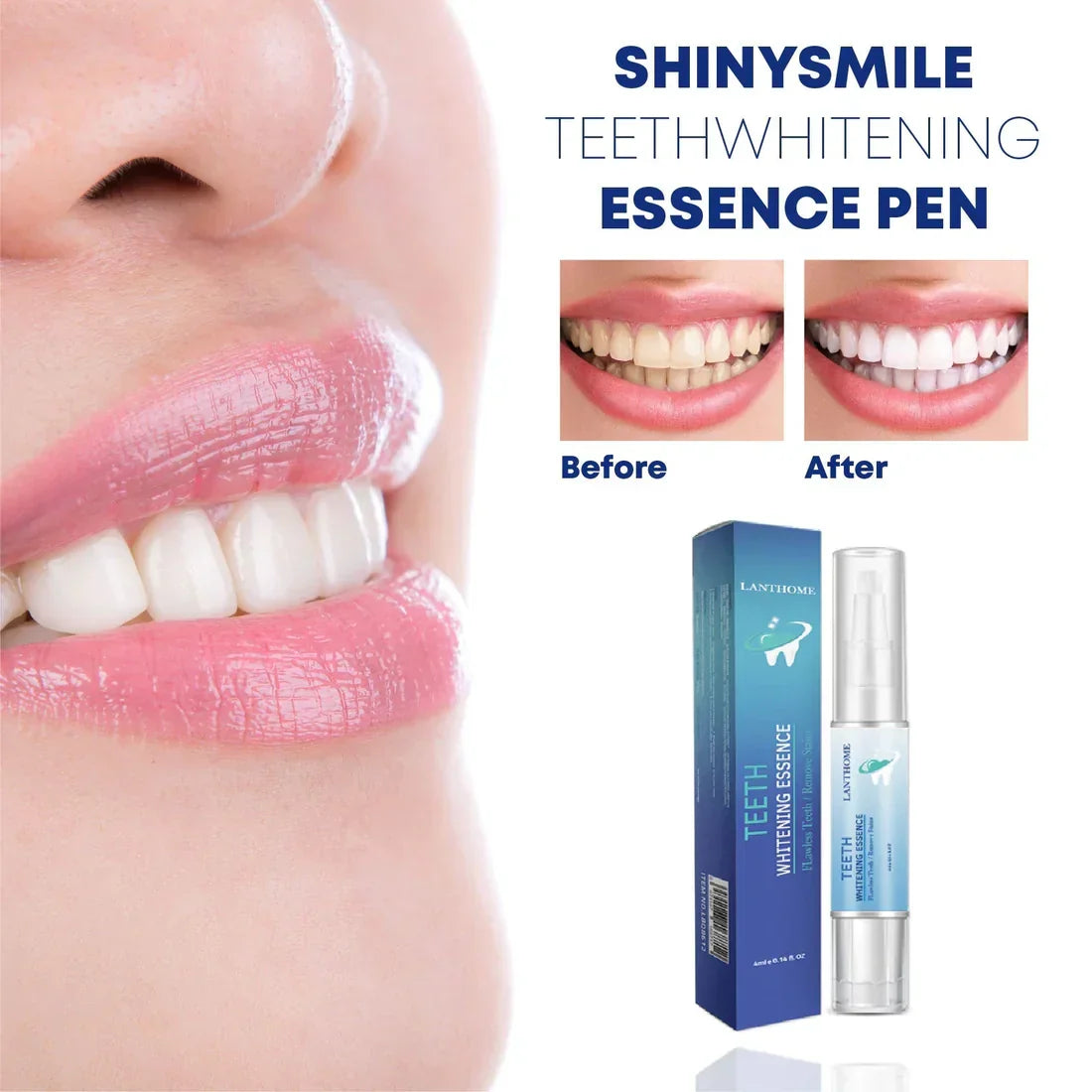 Teeth Whitening Pen | Enamel-Safe Formula with Protein | Removes Stubborn Stains for a Brighter, Confident Smile