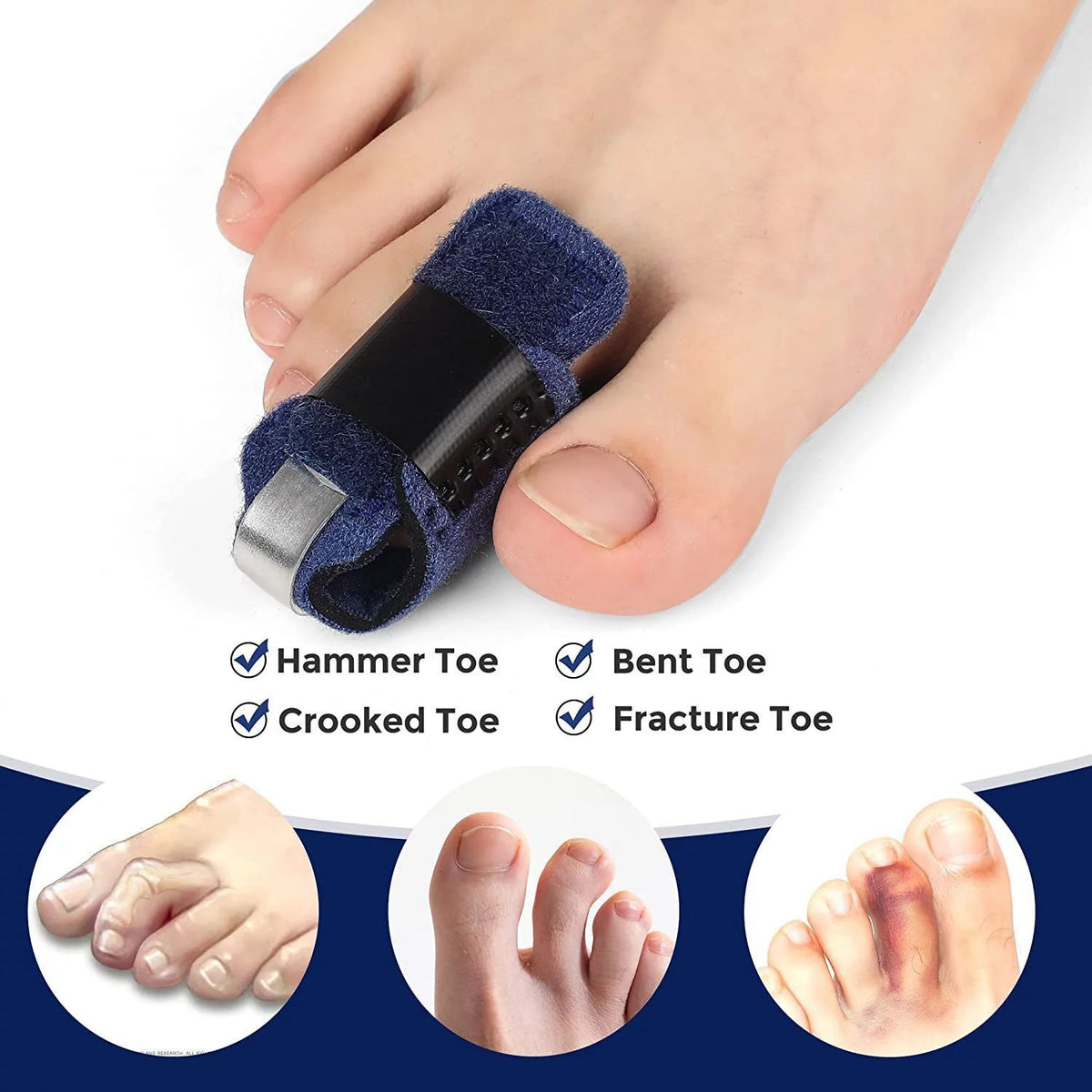Toe Corrector Brace for Women | Hammer Toe Straightener Splint | Breathable, Reusable Support for Day and Night Wear 4